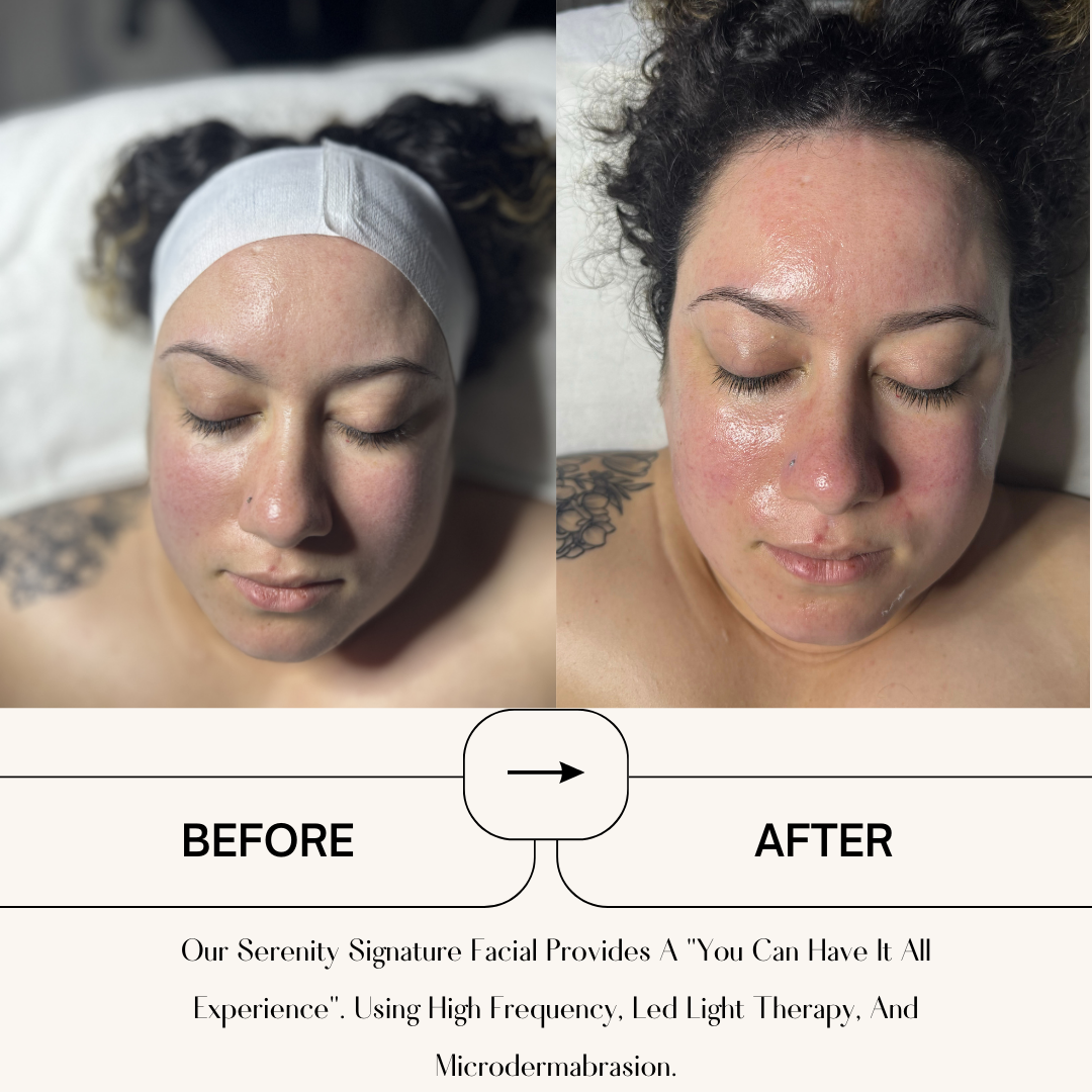 Beige Minimalist Skincare Before and After Instagram Post-2