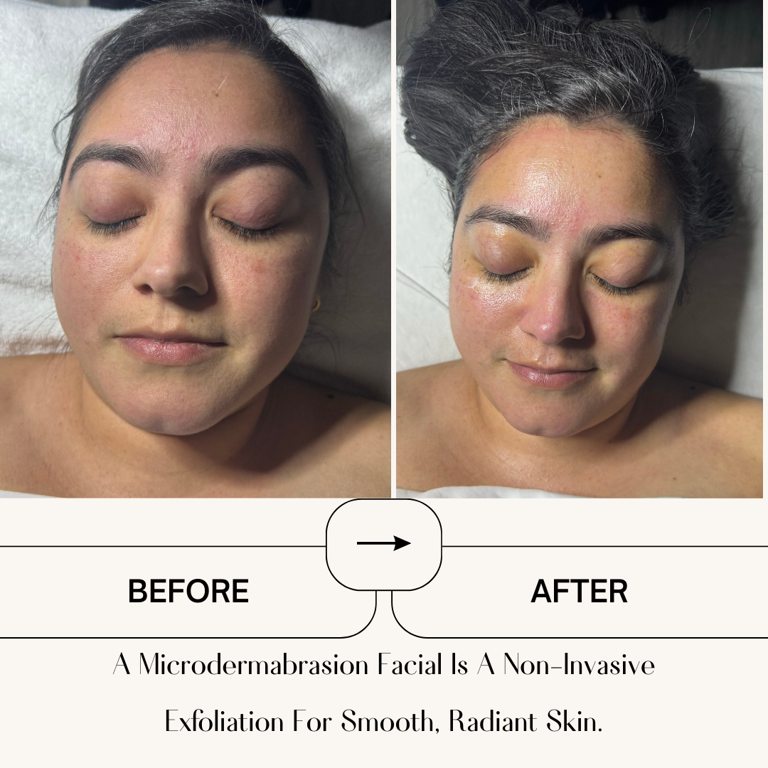 Beige Minimalist Skincare Before and After Instagram Post