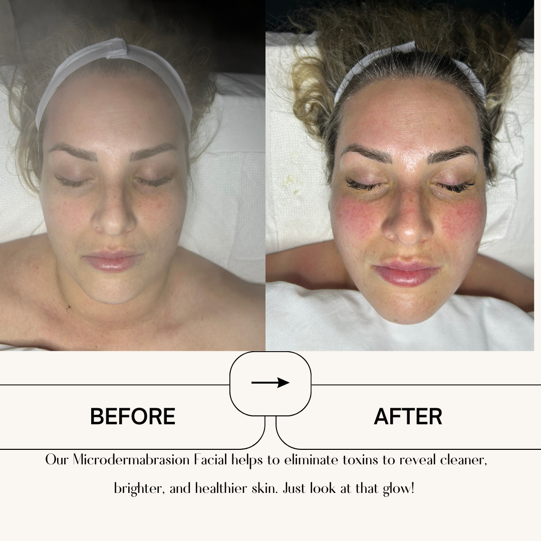 Beige Minimalist Skincare Before and After Instagram Post-5